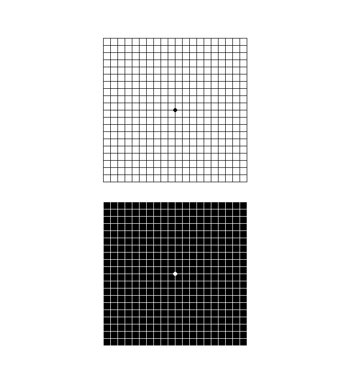 Macular Degeneration Test