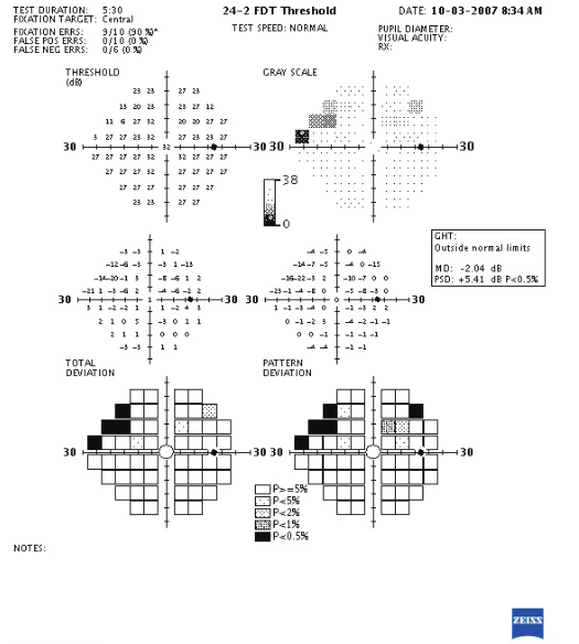 Frequency Doubling Technology