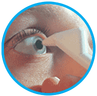 Intraocular_pressure_img